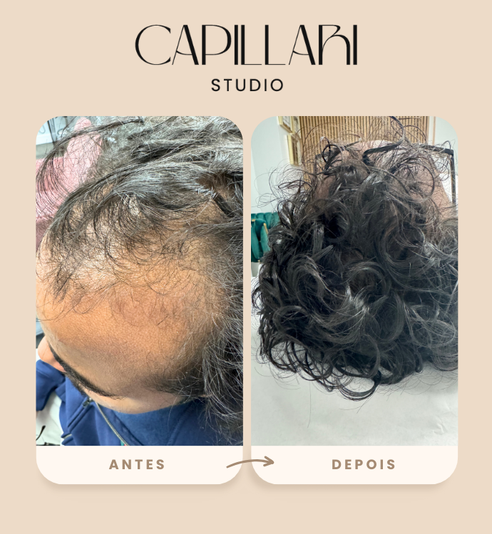 Resultado
