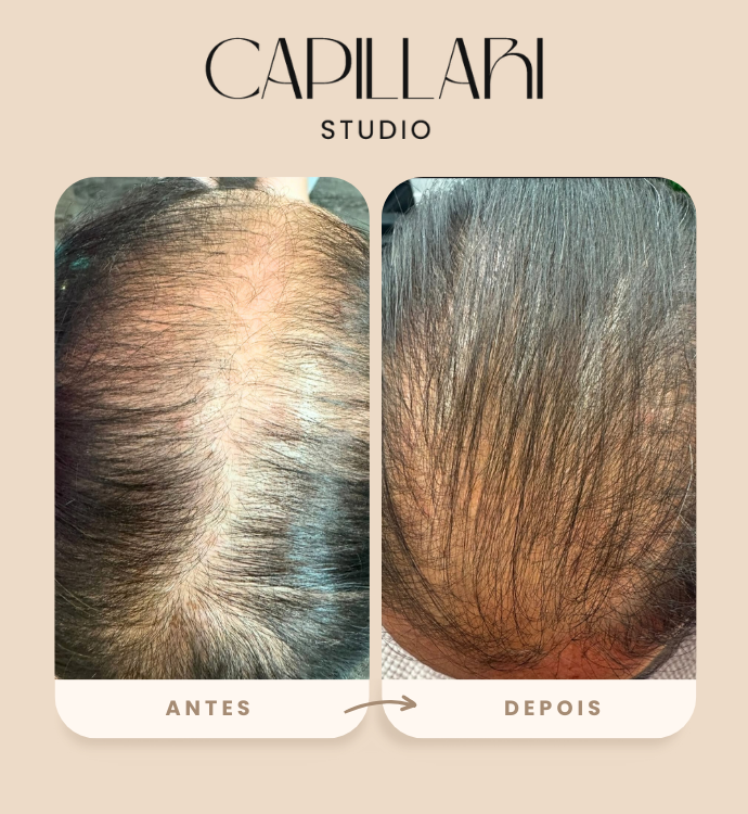 Resultado