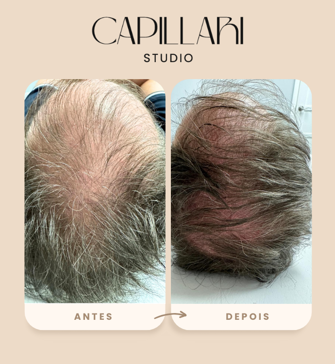 Resultado